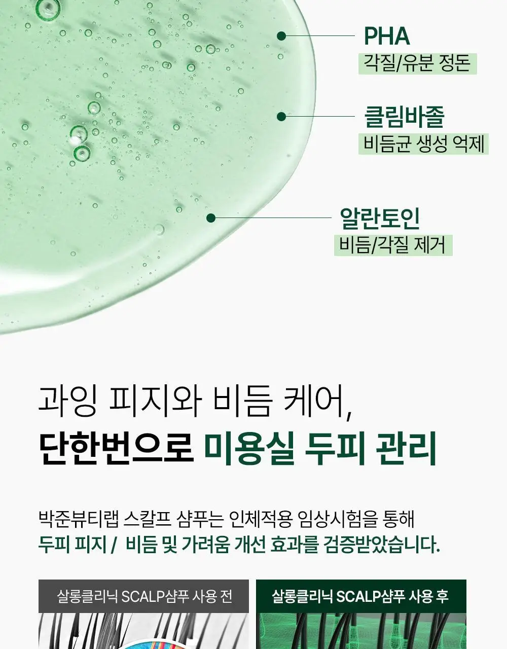 [각질/가려움] 박준뷰티랩 두피 클리닉 정수리 샴푸 500+200ml 두피샴푸 증정기획 상세페이지 14